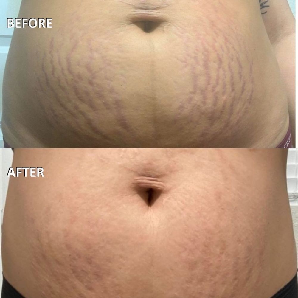 DOUT MAELLY'S Firming Belly Creme - Picture 3 of 8